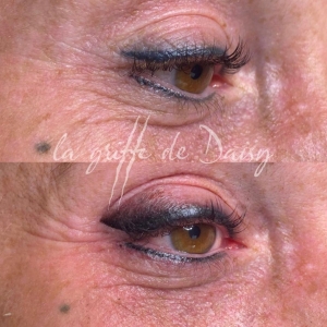 pigmentation-des-yeux-01