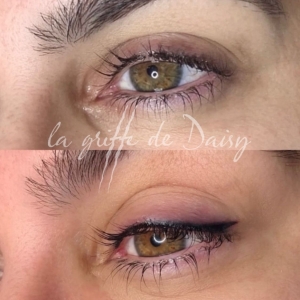 pigmentation-des-yeux-02