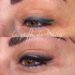 pigmentation-des-yeux-04