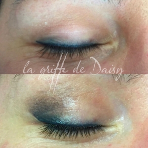 pigmentation-des-yeux-05