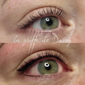 pigmentation-des-yeux-06