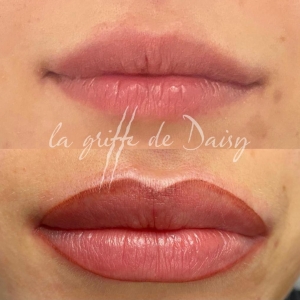 pigmentation-des-levres-01
