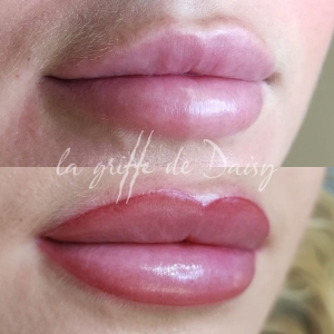 pigmentation-des-levres-02