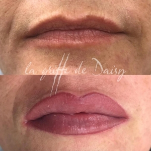 pigmentation-des-levres-03